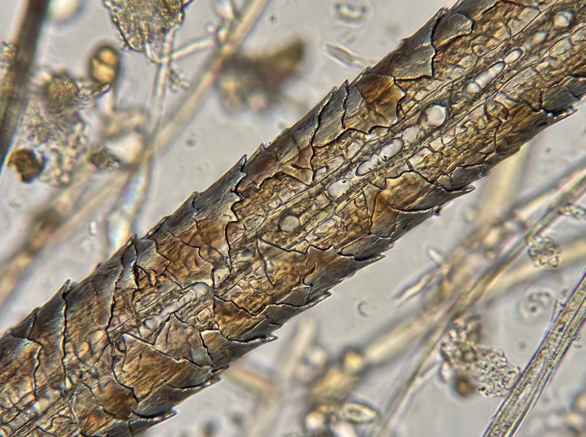 Microscopic View of a Subject 1